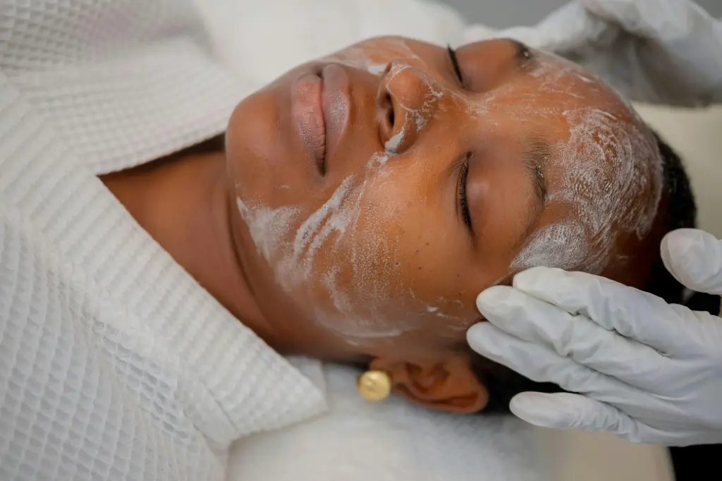 SUPERFICIAL CHEMICAL PEEL